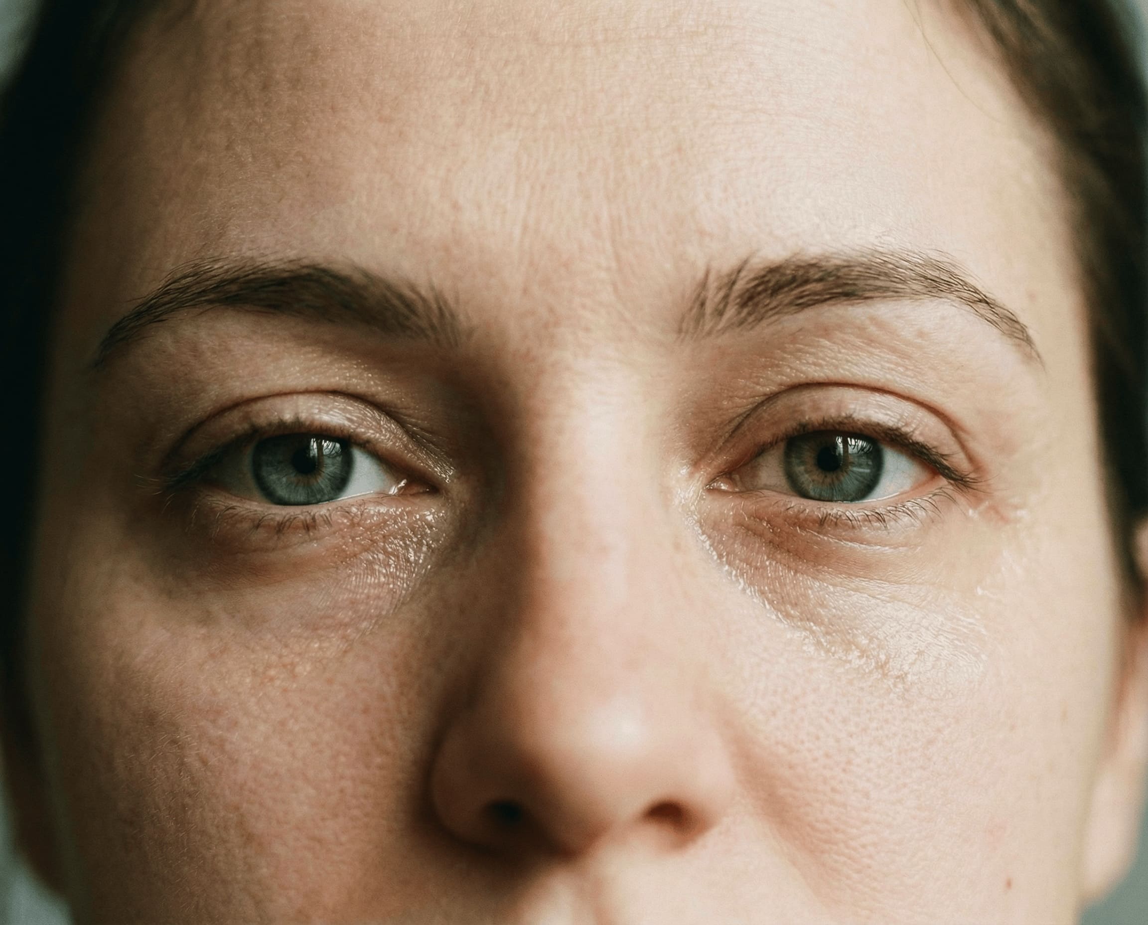 Prima del trattamento